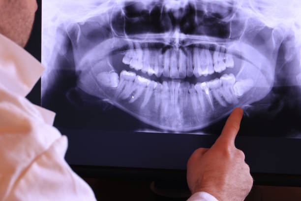 Best Emergency Dentist for Special Needs Patients in Herlong, CA